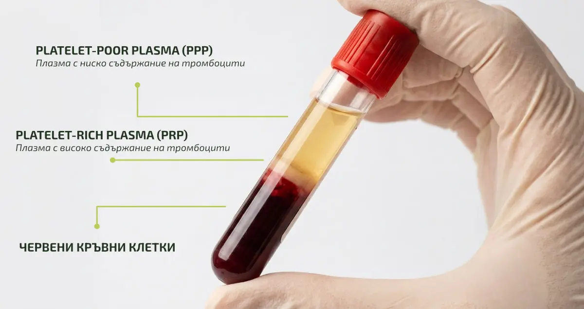 PRP терапия в гинекологията
