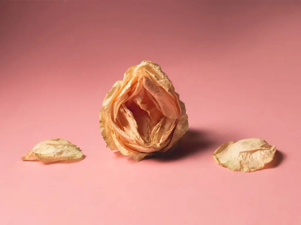 Вагинална релаксация