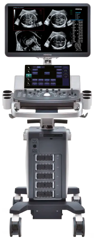 Mindray DC80-A X-Insight